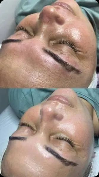Косметологические процедуры для лица и тела 1