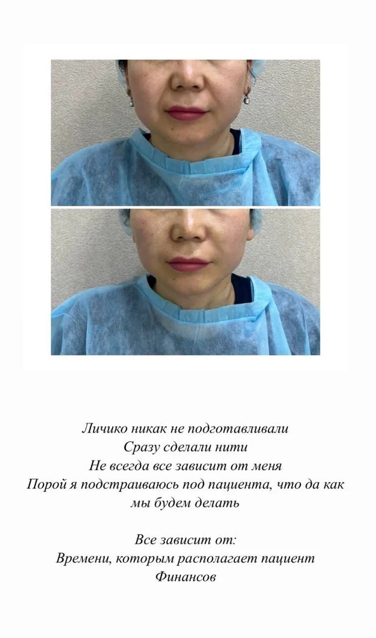 Услуги омоложения в Анталье 2